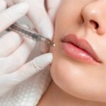 PN製剤💉注入後のリップの色素改善技術セミナー